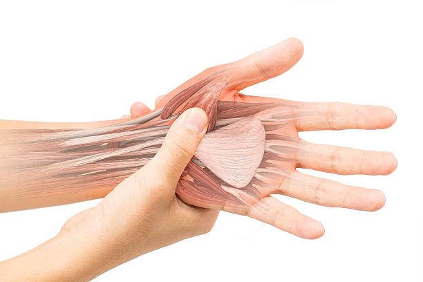 carpal tunnel syndrome, wrist pain