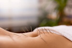 Acupuncture for digestive health