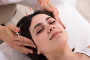 acupuncture for menopause symptoms