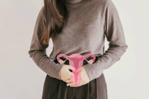 PCOS natural treatment